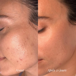 Niacinamide 10 TXA 4 Serum Anua